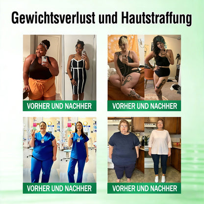 CareUplift® 🎁🎁 ABSOLUTE WAHN! 50 % RABATT – SOGAR WIR KÖNNEN NICHT GLAUBEN, DASS WIR DAS MACHEN!