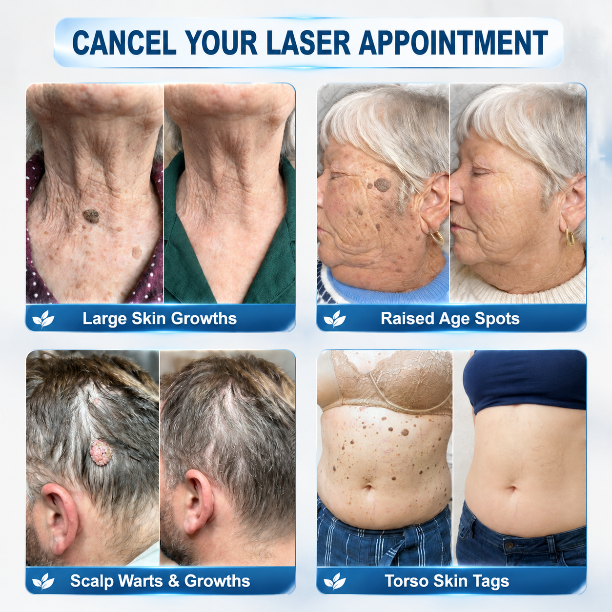 𝐇𝐢𝐬𝐤𝐢𝐧®CareUplift® 🎁ABSOLUTE MADNESS! 50% OFF — EVEN WE CAN’T BELIEVE WE’RE DOING THIS!🎁